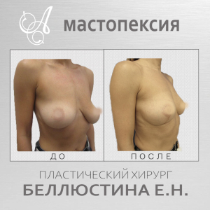 Различные позы для кормления грудью | Medela